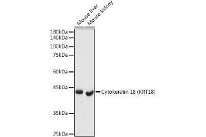 Western blot analysis of extracts of various cell lines, using Cytokeratin 18 (KRT18) antibody (ABIN7268098) at 1:3000 dilution.