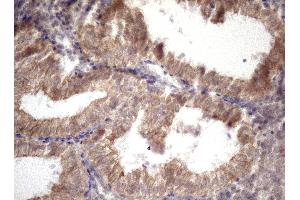Immunohistochemistry (IHC) image for anti-Amelotin (AMTN) antibody (ABIN2716038)