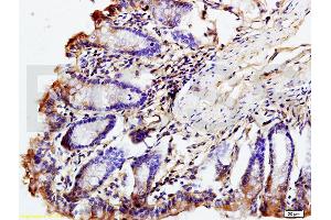 Formalin-fixed and paraffin embedded mouse intestine labeled with Rabbit Anti phospho-GCN2 (Thr667) Polyclonal Antibody, Unconjugated (ABIN684958) at 1:200 followed by conjugation to the secondary antibody and DAB staining