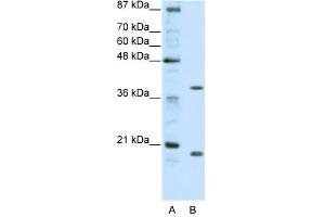 ZNF322A antibody used at 0. (ZNF322A anticorps  (C-Term))
