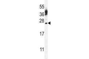 CT45A antibody western blot analysis in WiDr lysate (CT45A3 anticorps  (AA 106-135))