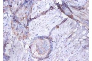 Immunohistochemistry of paraffin-embedded human prostate tissue using ABIN7154292 at dilution of 1:100 (GOLM1 anticorps  (AA 36-401))