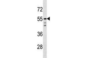 AKT1 antibody western blot analysis in T47D lysate