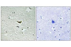 Immunohistochemical analysis of paraffin-embedded human brain tissue using CK-1α (Phospho-Tyr294) antibody (left)or the same antibody preincubated with blocking peptide (right). (CSNK1A1 anticorps  (pTyr294))