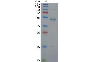 Human IL17C Protein, hFc Tag on SDS-PAGE under reducing condition.