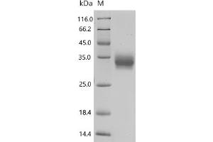 (Tris-Glycine gel) Discontinuous SDS-PAGE (reduced) with 5 % enrichment gel and 15 % separation gel.