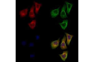 ABIN7094718 and ABIN7098769 staining Hela cells by IF/ICC.