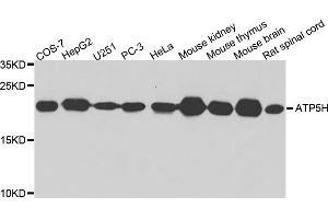 Western blot analysis of extract of various cells, using ATP5H antibody. (ATP5H anticorps)