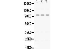 Western Blotting (WB) image for anti-Interleukin 2 Receptor, beta (IL2RB) (AA 503-539), (C-Term) antibody (ABIN3043246) (IL2 Receptor beta anticorps  (C-Term))