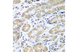 Immunohistochemistry of paraffin-embedded human stomach using EIF1AX antibody (ABIN5973507) at dilution of 1/100 (40x lens). (EIF1AX anticorps)