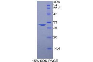 SDS-PAGE analysis of Human Sphingosine Kinase 1 Protein. (SPHK1 Protéine)