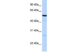 REEP4 antibody used at 1 ug/ml to detect target protein. (Receptor Accessory Protein 4 anticorps  (N-Term))