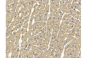 ABIN7096925 and ABIN7100991 at 1/100 staining rat heart tissue by IHC-P. (CLN8 anticorps)