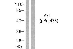 Western Blotting (WB) image for anti-V-Akt Murine Thymoma Viral Oncogene Homolog 1 (AKT1) (pSer473) antibody (ABIN1847446) (AKT1 anticorps  (pSer473))