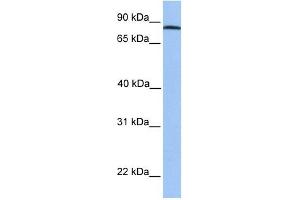 ADAM7 antibody used at 1 ug/ml to detect target protein.