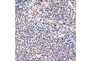 Immunohistochemistry of paraffin-embedded rat spleen using B Rabbit mAb (ABIN7265377) at dilution of 1:100 (40x lens).