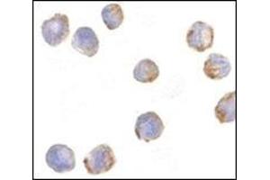 anti-MDM2 Binding Protein (MTBP) (AA 122-139), (Middle Region) antibody