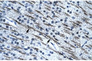 Rabbit Anti-SSBP2 Antibody Catalog Number: ARP31828 Paraffin Embedded Tissue: Human Brain Cellular Data: Nerve fibre Antibody Concentration: 4.