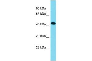 Host: Rabbit Target Name: C16orf91 Sample Type: Fetal Lung lysates Antibody Dilution: 1. (CCSMST1 anticorps  (C-Term))