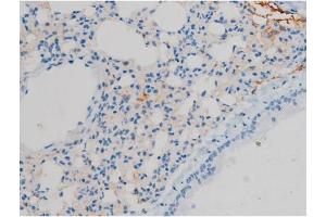ABIN6267410 at 1/200 staining Mouse lung tissue sections by IHC-P. (Connexin 43/GJA1 anticorps  (pSer368))