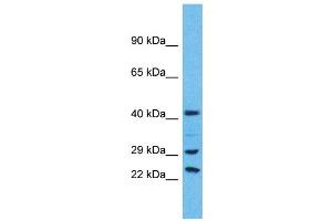 Western Blotting (WB) image for anti-Ubiquitin Specific Peptidase 41 (USP41) (C-Term) antibody (ABIN2791978) (USP41 anticorps  (C-Term))
