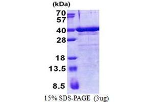 SDS-PAGE (SDS) image for Zinc Finger Protein 346 (ZNF346) (AA 1-294) protein (His tag) (ABIN5853212)