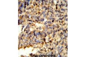 Immunohistochemistry (IHC) image for anti-Fc Fragment of IgG, Low Affinity IIc, Receptor For (CD32) (FCGR2C) antibody (ABIN3003995) (FCGR2C anticorps)