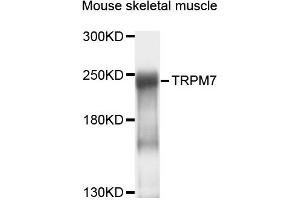 Western blot analysis of extracts of mouse skeletal muscle cells, using TRPM7 antibody. (TRPM7 anticorps)