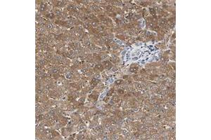 Immunohistochemical staining of human lymph node with C3orf52 polyclonal antibody  shows strong cytoplasmic positivity in reaction center cells at 1:200-1:500 dilution. (C3orf52 anticorps)