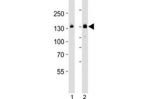 Western blot analysis of lysate from HT-29 cell line and mouse spleen tissue lysate (left to right) using JAK1 antibody; Ab was diluted at 1:1000 for each lane. (JAK1 anticorps  (C-Term))