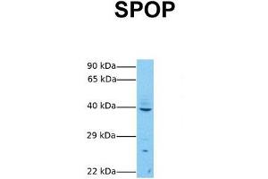 Host:  Rabbit  Target Name:  SPOP  Sample Tissue:  Human MCF7  Antibody Dilution:  1. (SPOP-B anticorps  (C-Term))