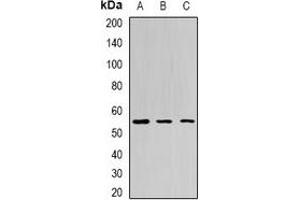 Western blot analysis of BPI expression in Jurkat (A), HepG2 (B), mouse liver (C) whole cell lysates. (BPI anticorps)