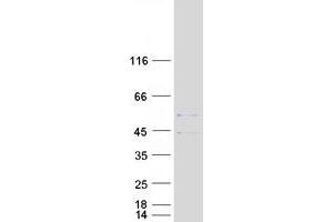 Validation with Western Blot