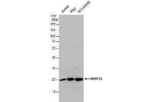 WB Image NDUFS3 antibody detects NDUFS3 protein by western blot analysis.