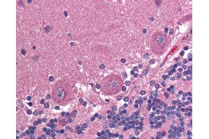 Anti-CCT2 antibody IHC of human brain, cerebellum.