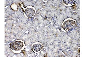 IHC analysis of Crp using anti- Crp antibody .