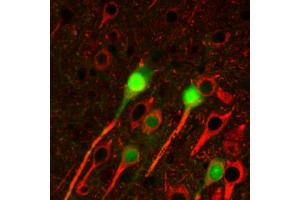 Immunohistochemistry staining of betaIII tubulin (red) in tissue sections of murine brain expressing GFP in some of its neurons (green). (TUBB3 anticorps  (N-Term))