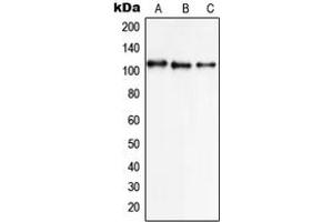 Western blot analysis of NCX1 expression in K562 (A), A549 (B), HL60 (C) whole cell lysates. (SLC8A1 anticorps  (Center))