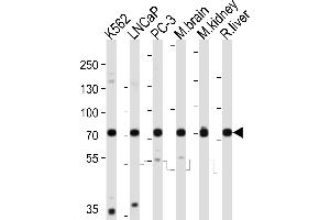 Western blot analysis of lysates from K562, LNCaP, PC-3 cell line, mouse brain, mouse kidney, rat liver tissue lysate (from left to right), using C Antibody (C-term) (ABIN6243097 and ABIN6577815). (CD164 anticorps  (C-Term))