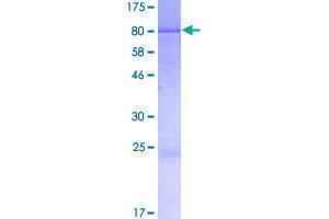 Image no. 1 for Pyrin and HIN Domain Family, Member 1 (PYHIN1) (AA 1-461) protein (GST tag) (ABIN1316991)