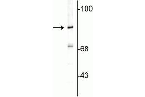 Western blot of rat cortical lysate showing specific immunolabeling of the ~82 kDa rabphilin 3A.