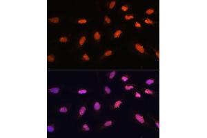 Immunofluorescence analysis of U-2 OS cells using BA antibody (ABIN7265937) at dilution of 1:100. (BAZ2A anticorps)