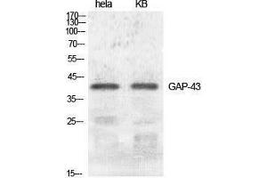 Western Blotting (WB) image for anti-Growth Associated Protein 43 (GAP43) (Ser421) antibody (ABIN3184740) (GAP43 anticorps  (Ser421))