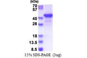 SDS-PAGE (SDS) image for Bestrophin 1 (BEST1) (AA 292-585) protein (His tag) (ABIN5853599)