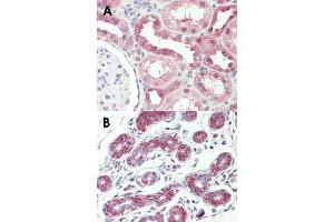 Immunohistochemical staining (Formalin-fixed paraffin-embedded sections) of human kidney (A) and human breast (B) with AVPR1A monoclonal antibody, clone 721CT25. (AVPR1A anticorps  (AA 353-383))