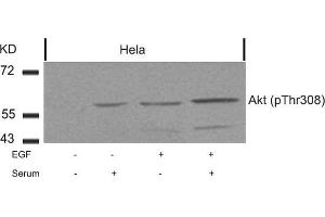 Western blot analysis of extracts from Hela cells untreated or treated with EGF, serum or both using Akt(Phospho-Thr308) Antibody. (AKT1 anticorps  (pThr308))