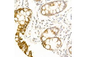 Immunohistochemistry of paraffin-embedded human colon using USP18 Rabbit pAb (ABIN7271145) at dilution of 1:25 (40x lens). (USP18 anticorps  (AA 200-300))