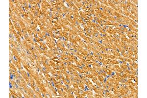 ABIN6259192 and ABIN6274507 at 1/100 staining Rat heart tissue by IHC-P.