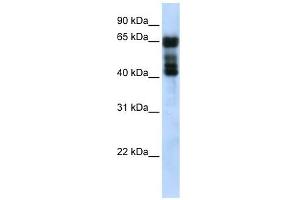UGT2B4 antibody used at 1 ug/ml to detect target protein. (UGT2B4 anticorps  (N-Term))