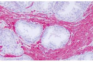 Image no. 2 for anti-Actin, gamma 2, Smooth Muscle, Enteric (ACTG2) (C-Term) antibody (ABIN6749799)